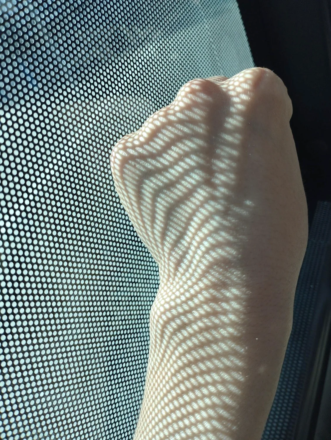 Dappled light across skin — an imaginary study